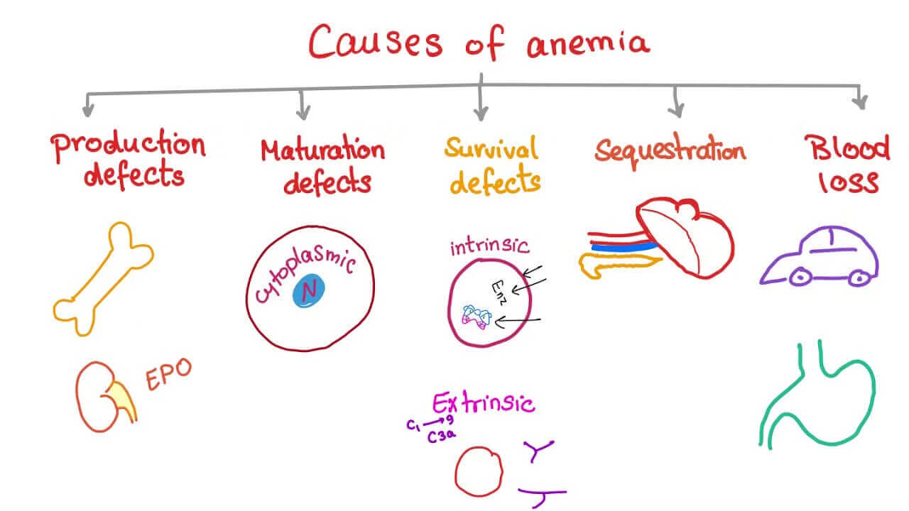 Anemia Causes