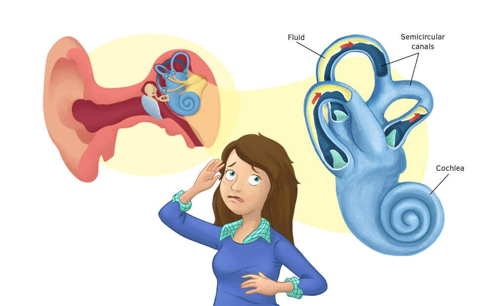 Motion Sickness Explain