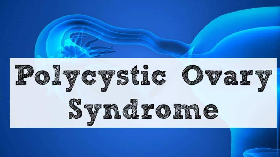 Polycystic Ovary Syndrome