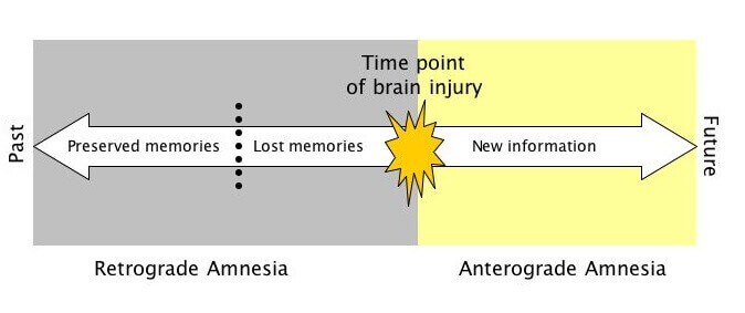 Amnesia Types