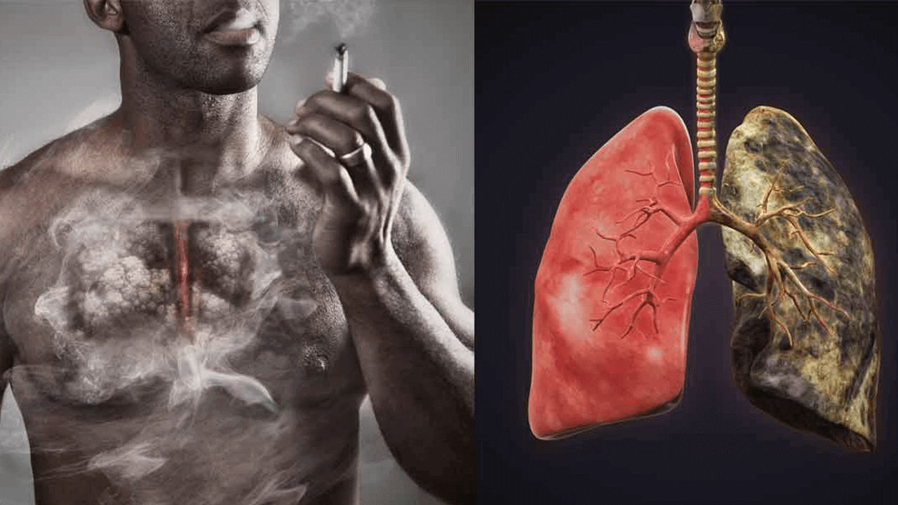 Smoking And COPD