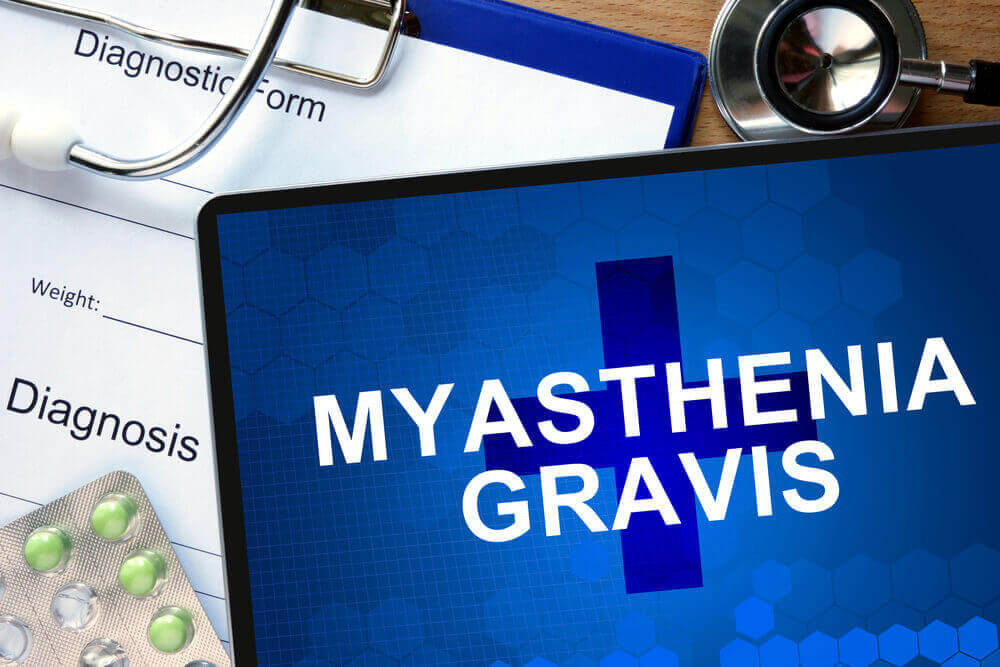 Myasthenia Gravis Diagnosis And Treatment