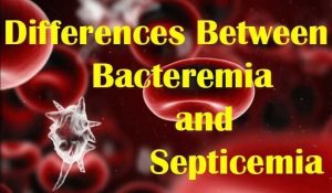 Bacteremia VS. Septicemia