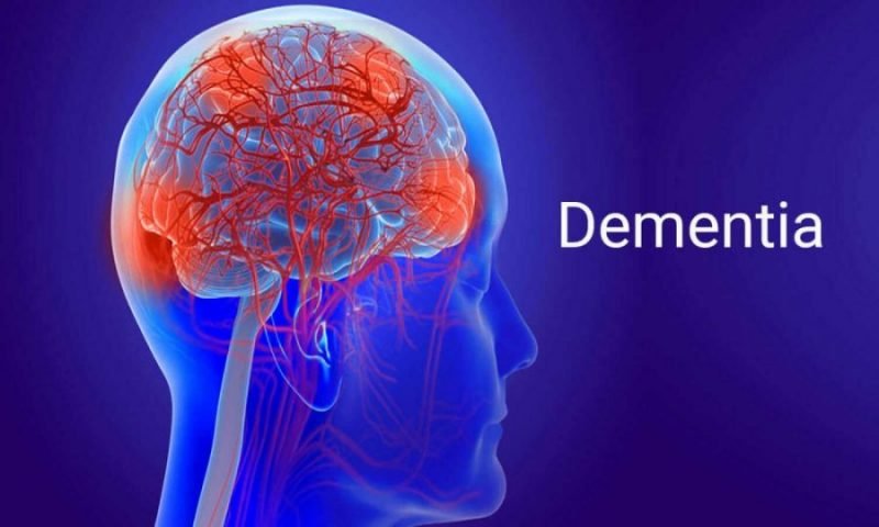 Dementia Stages And Symptoms Briefly Explained - Health Blog